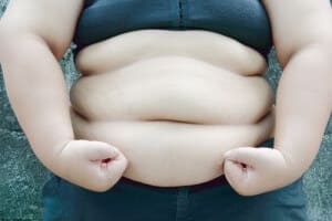 Фото людей с лишним весом