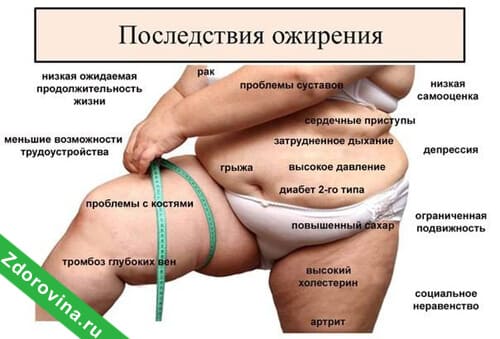 Последствия ожирения